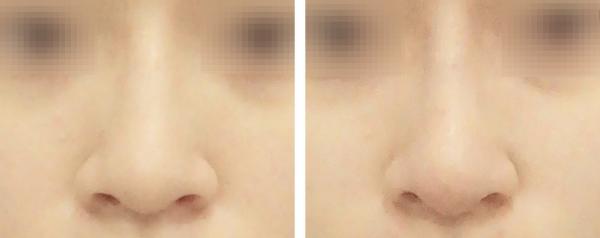 홍대점_바비코